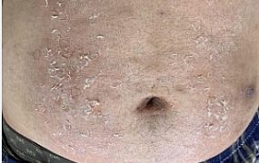 超细打磨的鞋跟大腿钻血洞，10和12厘米高跟跺肚子 YC-211012-3