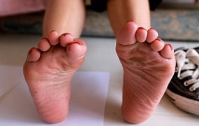 【芊芊】帆布鞋拖裸足踩金鱼爆浆