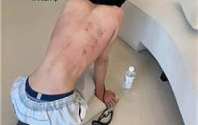 【精神小妹】伤痕累累可怜的贱奴 JS241014-20