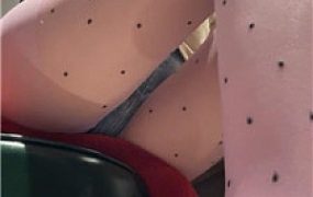 【凹凸曼】早些治疗    250303-4