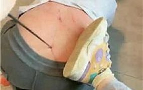 【玉不了】双S-精神小妹重刑虐 JS250520-29