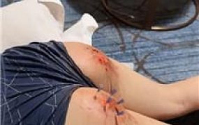 【小渔】针扎屁股掐乳头 JS250613-21