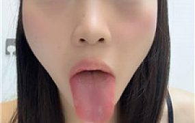 【凹凸曼】浓痰盯    250817-3